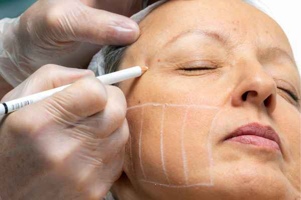 CryoPen: 5 Skin Concerns It May Be Used to Treat 4 What should you ask before having CryoPen treatment Edgbaston?