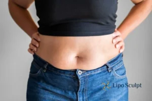 Bidding Farewell to Muffin Tops with Aqualyx Fat Injections 2 Do you wish you could reduce your muffin top Edgbaston With Aqualy fat dissolving injections you can!
